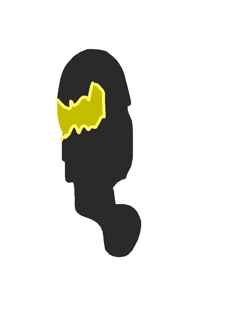 When No Visor Gets Crazy (For no Visor)